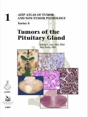 Tumors of the Pituitary Gland(AFIP Atlas of Tumor and Non-Tumor Pathology, Series 5) 2020