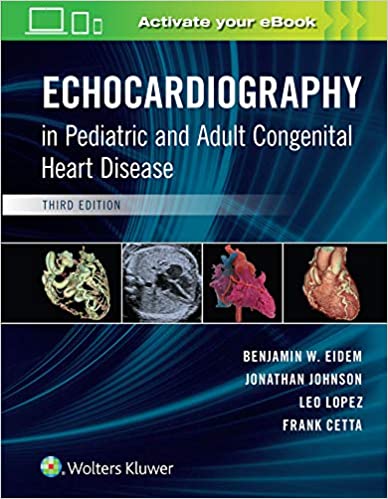 Echocardiography in Pediatric and Adult Congenital Heart Disease 3/E 2021