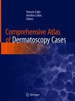 Comprehensive Atlas of Dermatoscopy Cases 2018