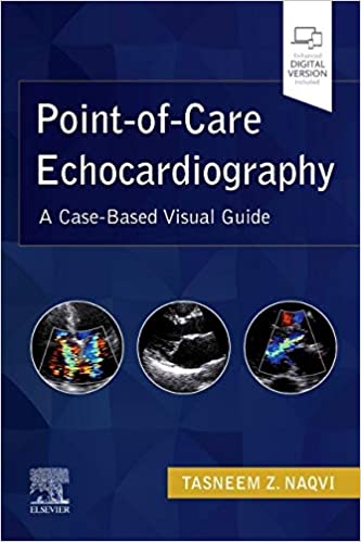 Point-of-Care Echocardiography: A Clinical Case-Based Visual Guide 2022