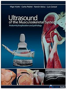 Ultrasound of the Musculoskeletal System. Anatomical Exploration and Pathology 2021