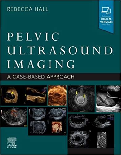 Pelvic Ultrasound Imaging: A Cased-Based Approach 2022