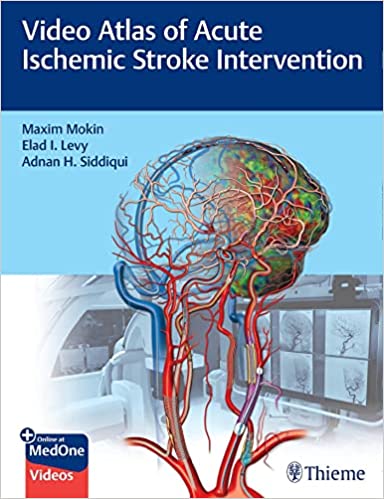 Video Atlas of Acute Ischemic Stroke Intervention 2022