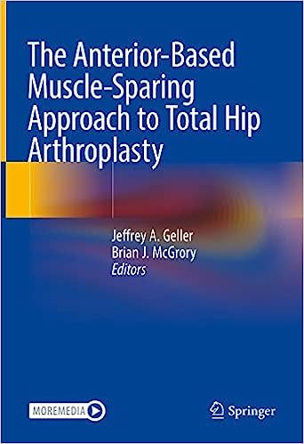 The Anterior-Based Muscle-Sparing Approach to Total Hip Arthroplasty 2022