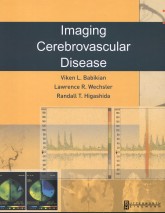 Imaging Cerebrovascular Disease
