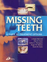 Missing Teeth A Guide to Treatment Options