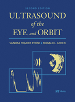 Ultrasound of the Eye and Orbit, 2nd Edition