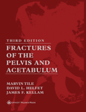 Fractures of the Pelvis and Acetabulum , Hardbound(已缺書)