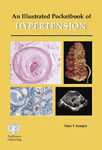 An Illustrated Pocketbook of Hypertension