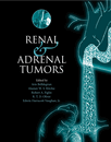 Renal and Adrenal Tumors - Biology and management