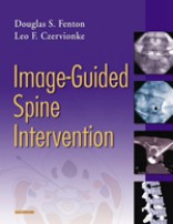 Image Guided Spine Intervention(已絕版，無法供應，請勿下訂)