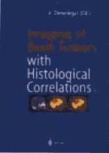 Imaging of Brain Tumors with Histological Correlations