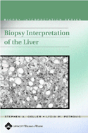 Biopsy Interpretation of the Liver : Hardbound with CDROM