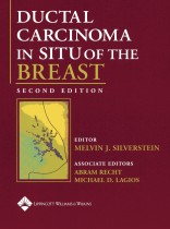 Ductal Carcinoma in Situ of the Breast , Hardbound