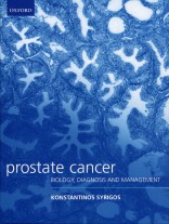 Prostate Cancer Biology , Diagnosis and Managemnet