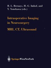 Intraoperative Imaging in Neurosurgery : MRI, CT, Ultrasound