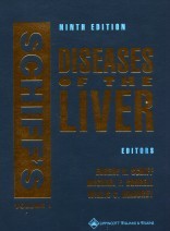 Schiff's Diseases of the Liver / Two-Volume Set