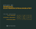 Atlas of Neonatal Electroencephalography: Hardbound