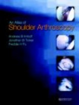 Atlas of Shoulder Arthroscopy
