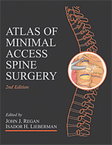 Minimal Access Spine Surgery 2/E 2004