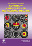 An Atlas and Manual of Coronary Intravascular Ultrasound Imaging(已缺書)