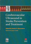 Ultrasound and Stroke Prevention and Treatment