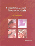 Surgical Management of Endometriosis