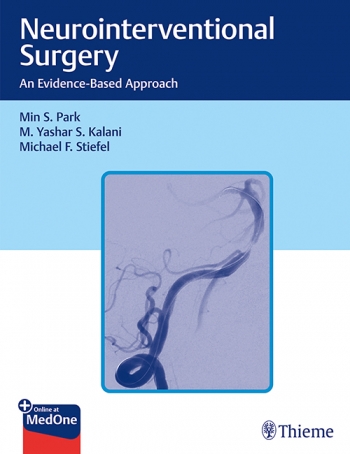 Neurointerventional Surgery: An Evidence-Based Approach 2021