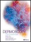 Dermoscopy
