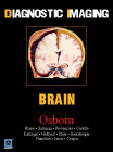 Diagnostic Imaging - Brain(已缺書)