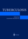 Tuberculosis