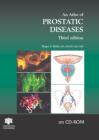 An Atlas of Prostatic Diseases