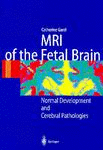 MRI of the Fetal Brain: Normal Development and Cerebral Pathologies