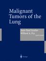 Malignant Tumors of the Lung Evidence-based Management