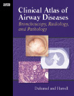 Clinical Atlas of Airway Disease: Bronchoscopy, Radiology and Pathology(已缺書)