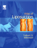 Atlas of Liposuction