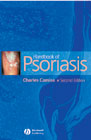 Handbook of Psoriasis Second Edition