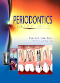 Periodontics - Medicine, Surgery and Implants