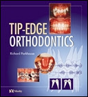 Tip-Edge Orthodontics