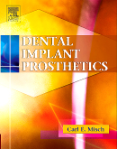 Dental Implant Prosthetics