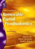 McCracken's Removable Partial Prosthodontics, 11th Edition