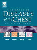 Synopsis of Diseases of the Chest, 3rd Edition