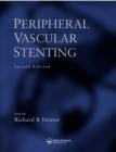 Peripheral Vascular Stenting :2nd Edition