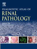 Diagnostic Atlas of Renal Pathology  2005  缺貨