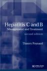Hepatitis C and B:Management and Treatment  2/e