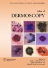Atlas of Dermoscopy