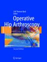 Operative Hip Arthroscopy 2005