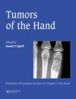 Tumors of the Hand :Published in association with the Federation of European Societies for Surgery of the Hand