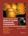 Atlas of Fundus Fluorescein Angiography
