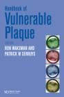 Handbook of the Vulnerable Plaque